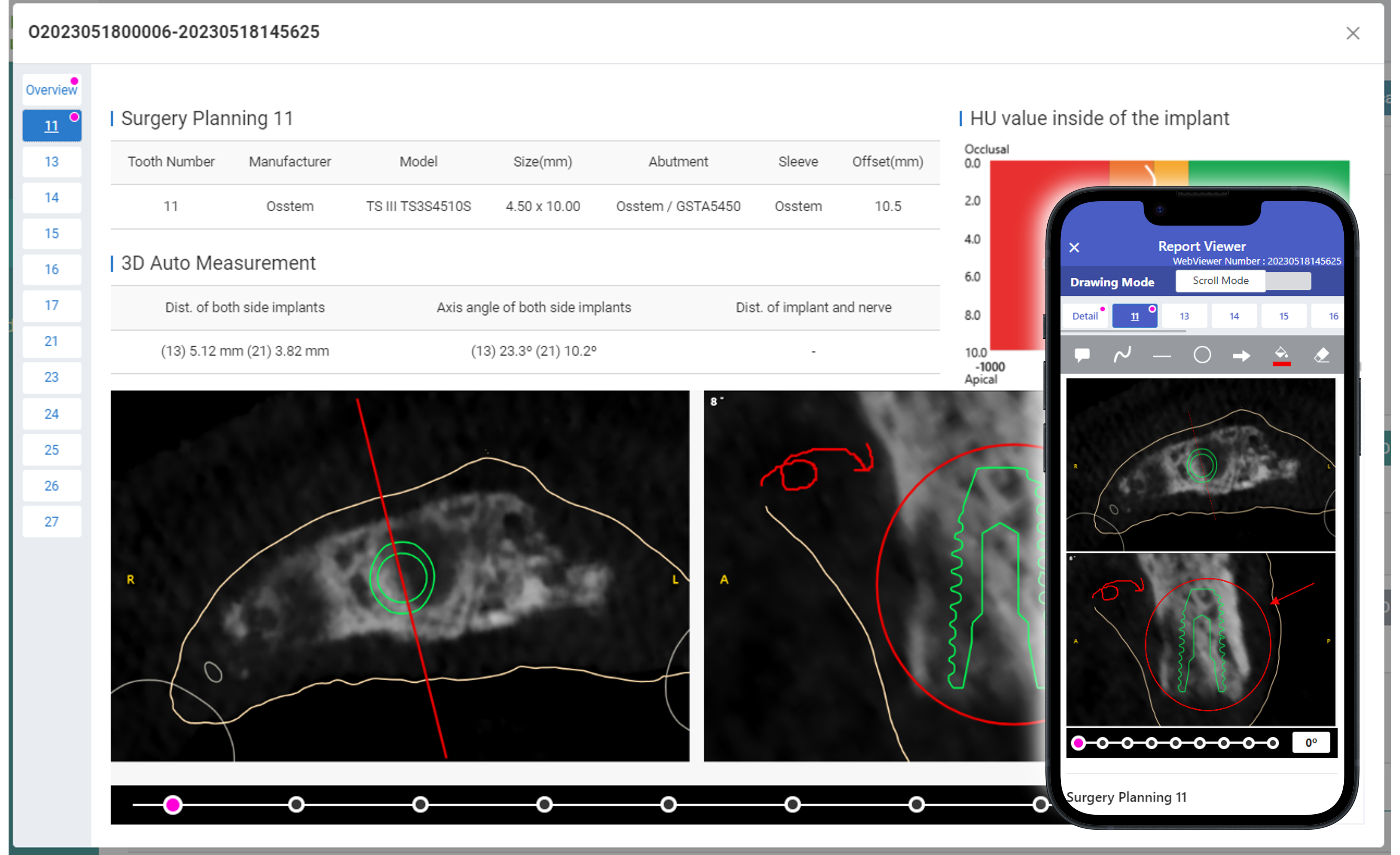 DentiqLink_2_WebViewer_03